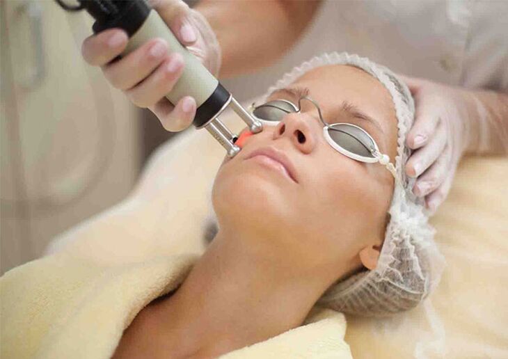 Lazerinė odos atjauninimo procedūra aplink akis